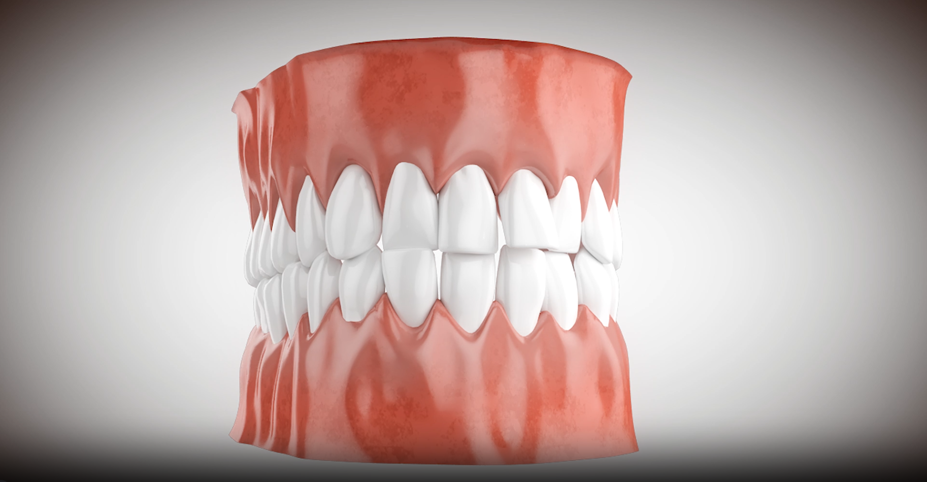 3D rendered human teeth and gums model showing upper and lower jaw with detailed tooth structure on a neutral gray background